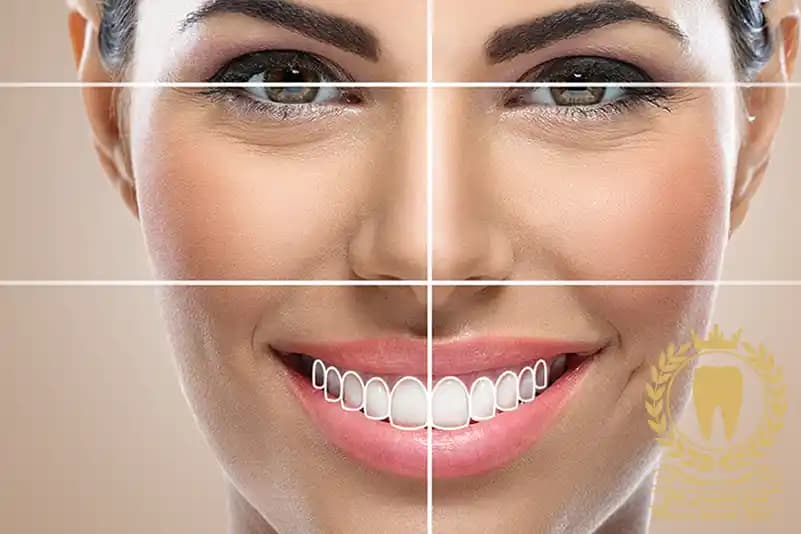 اصلاح طرح لبخند با طراحی دیجیتال