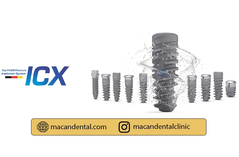 همه چیز در مورد ایمپلنت icx آلمان