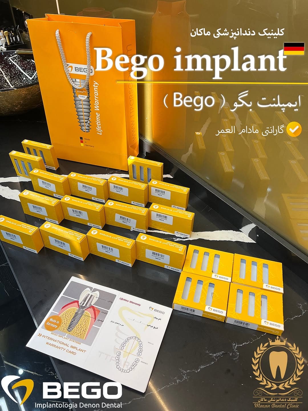 ایمپلنت بگو (bego implant)