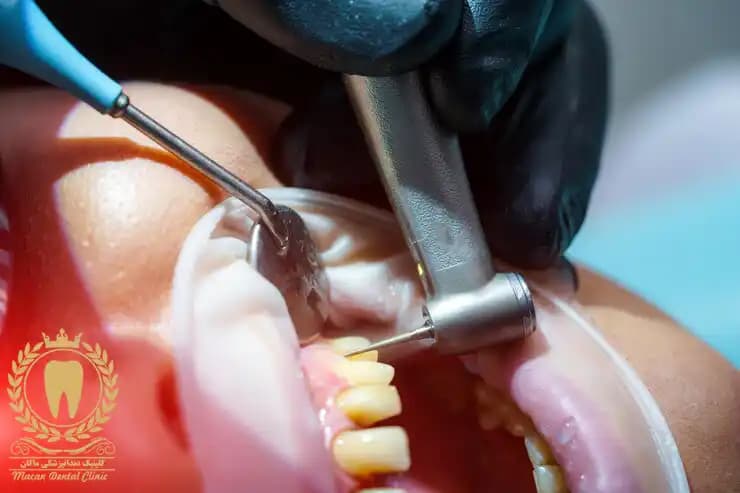 متخصص جراحی لثه متخصص جراحی لثه
