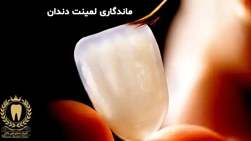 عمر لمینت دندان چه قدر است؟