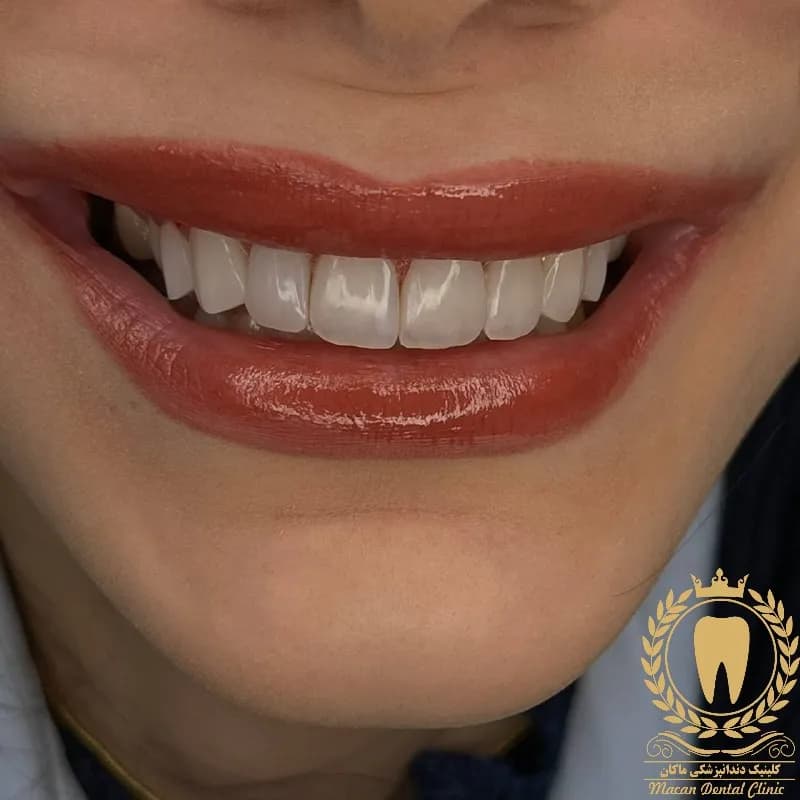 زیبایی زیبایی