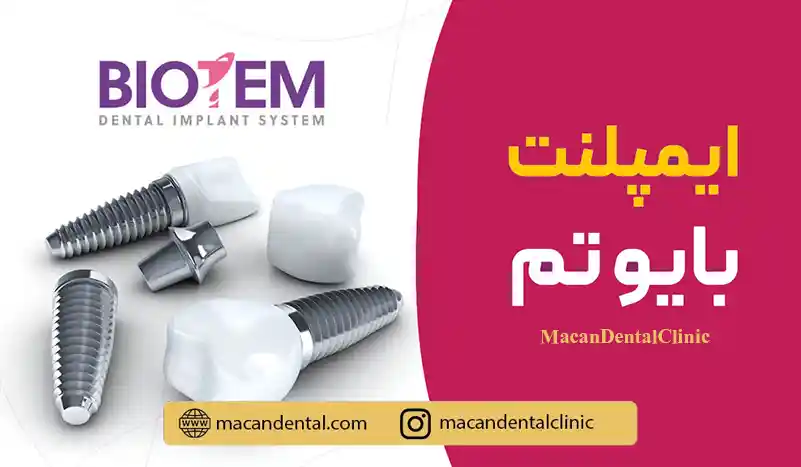 ایمپلنت بیوتم (Biotem)؛ راهنمای جامع و قیمت، مزایا و معایب